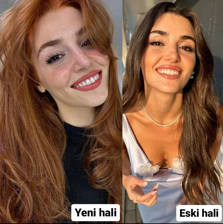 Görsel 1
