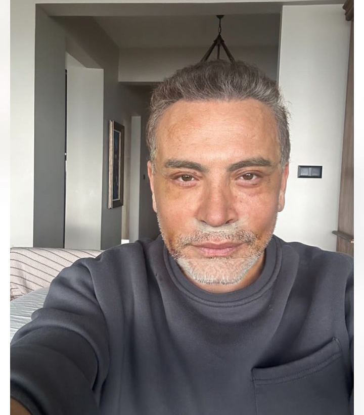 Görsel 1